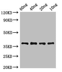 Lipoate-protein ligase A Antibody