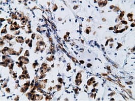 KHK / Ketohexokinase Antibody (clone OTI3D1)