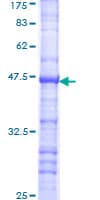 Human RPS6KB2 / S6K2 Protein (Recombinant GST, N-terminus)