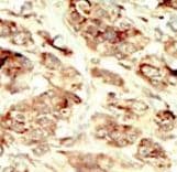 STK35 Antibody (aa374-404)