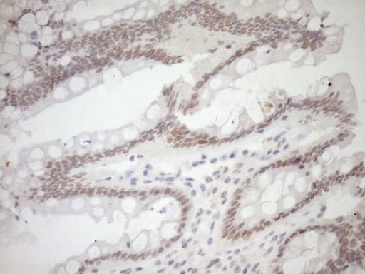 NR1I3 / CAR Antibody (aa1-236, clone OTI10B1)