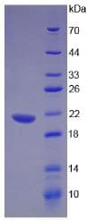 Rat LTA / TNF Beta Protein (Recombinant His-T7)