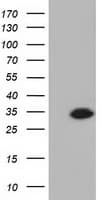 Monoclonal Mouse anti-Human KHK / Ketohexokinase Antibody (clone OTI4B8, IF, WB)