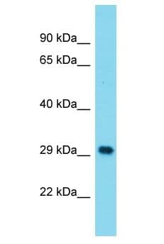 Polyclonal Rabbit anti-Human MAGEB5 Antibody (aa12-61, WB)