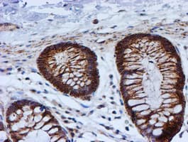 PSMB9 Antibody (clone OTI1G7)