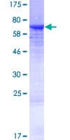 Human KRT25 / Keratin 25 Protein (Recombinant GST)