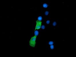 SSSCA1 / p27 Antibody (clone OTI2F5)
