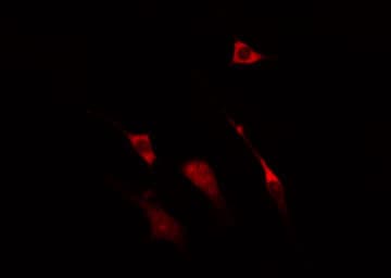 NCBP1 / CBP80 Antibody