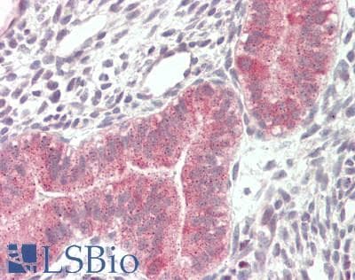IHC-plus™ VPS16 Antibody (aa358-371)