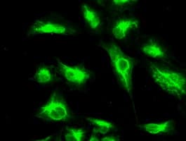CTAG1B / NY-ESO-1 Antibody (clone OTI3F10)