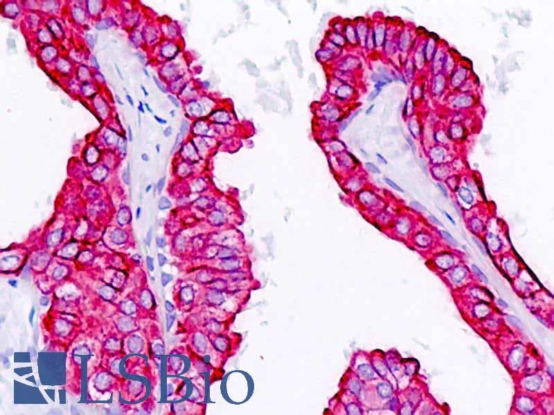 IHC-plus™ KRT18 / CK18 / Cytokeratin 18 Antibody (aa401-430)