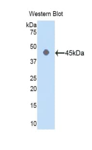 ACTG1 / Gamma Actin Antibody (aa1-375)