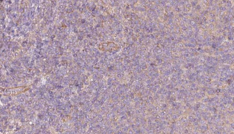 PKLR Antibody