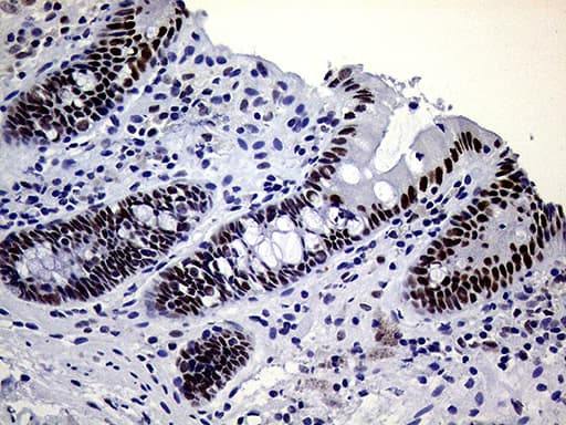 ERCC3 / XPB Antibody (aa191-436, clone OTI6H8)