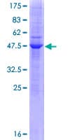 Human CEACAM21 Protein (Recombinant GST)