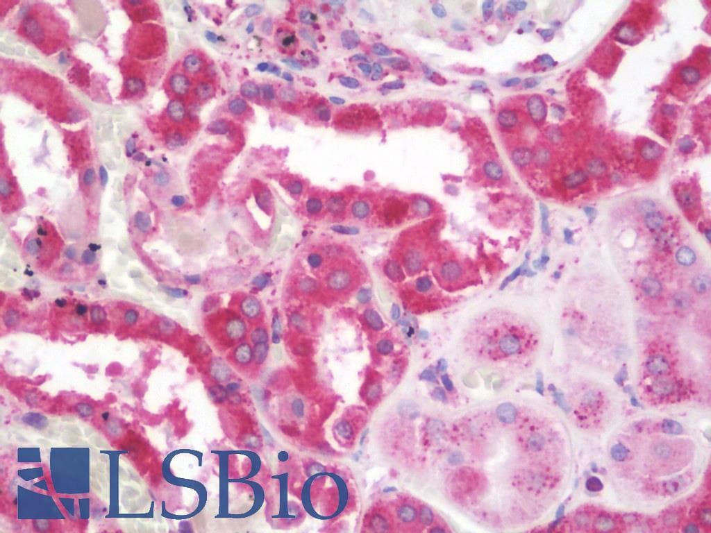 IHC-plus™ PDIA3 / ERp57 Antibody (C-Terminus)