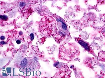 PathPlus™ Polyclonal Rabbit anti-Human GPR49 / LGR5 Antibody (Cytoplasmic Domain, IHC)