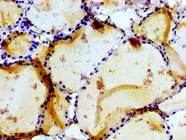 GRIK1 / GLUR5 Antibody