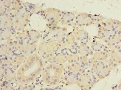 CWF19L1 Antibody