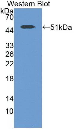 ENO2 / NSE Antibody (clone A4)