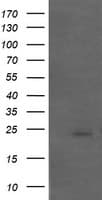 APCS / Serum Amyloid P / SAP Antibody (clone OTI5A9)
