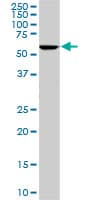 IHC-plus™ Monoclonal Mouse anti-Human STI1 / STIP1 Antibody (clone 1E3, IHC, IF, WB)