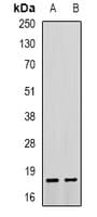 TNNC1 / Cardiac Troponin C Antibody