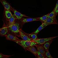 EEF2 / Elongation Factor 2 Antibody (clone 5B6)
