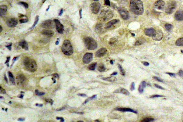 NBN / Nibrin Antibody (phospho-Ser343)
