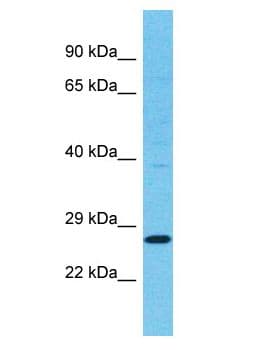 TSPAN11 Antibody (aa125-174)