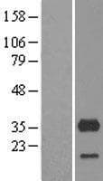 CYB5R3 / B5R Protein (Over-Expression Lysate Myc-DDK (Flag))