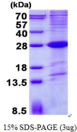 Human SLAMF6 / NTBA Protein (Recombinant His)