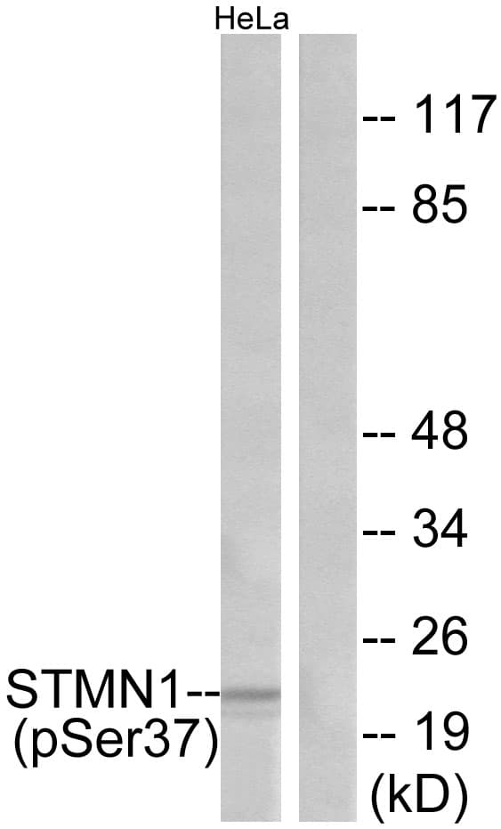 STMN1 / Stathmin / LAG Antibody (phospho-Ser37)