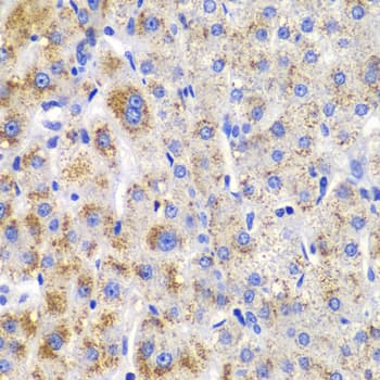Polyclonal Rabbit anti-Human CBLB Antibody (IHC, WB)