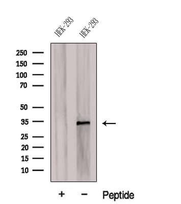CDCA4 Antibody