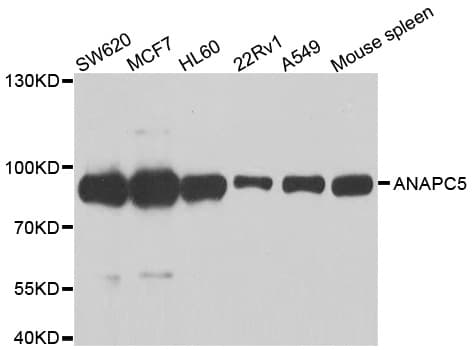 ANAPC5 / APC5 Antibody (AP)