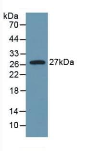 IL6 / Interleukin 6 Antibody