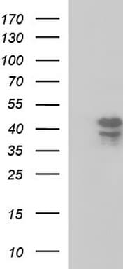 Monoclonal Mouse anti-Human SEPT1 / Septin 1 Antibody (clone OTI1E1, WB)