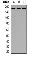IRS1 Antibody (Internal)