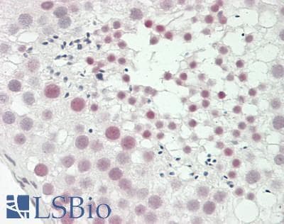 IHC-plus™ SF1 Antibody (aa45-98)