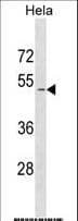 SMAD1 Antibody (aa1-30)