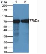 TF / Transferrin Antibody (aa318-453)