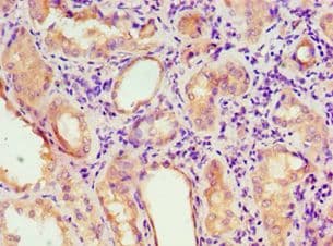 AGPAT1 Antibody (aa204-283)