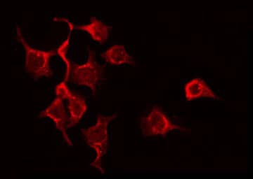 L1CAM Antibody