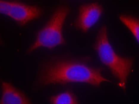 Polyclonal Rabbit anti-Human MAPT / Tau Antibody (phospho-Ser262, IHC, IF, WB)