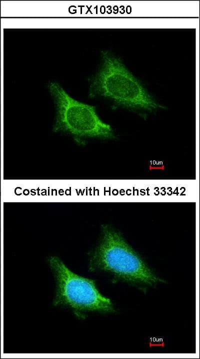Polyclonal Rabbit anti-Human MRPS5 Antibody (aa1-430, IHC, WB)