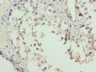 L3MBTL4 Antibody