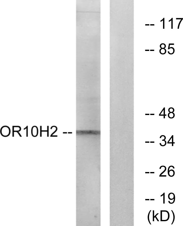 OR10H2 Antibody (aa241-290)