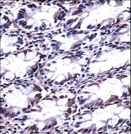 CFL2 / Cofilin 2 Antibody (aa25-54)