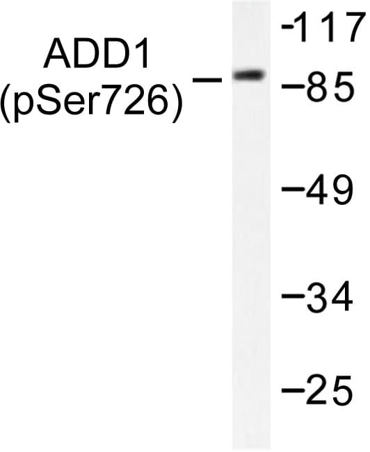 Polyclonal Rabbit anti-Human ADD1 / Adducin Alpha Antibody (phospho-Ser726, IHC, WB)